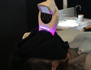 ワイトニングの薬液を歯に塗り、暖かい光を当てます