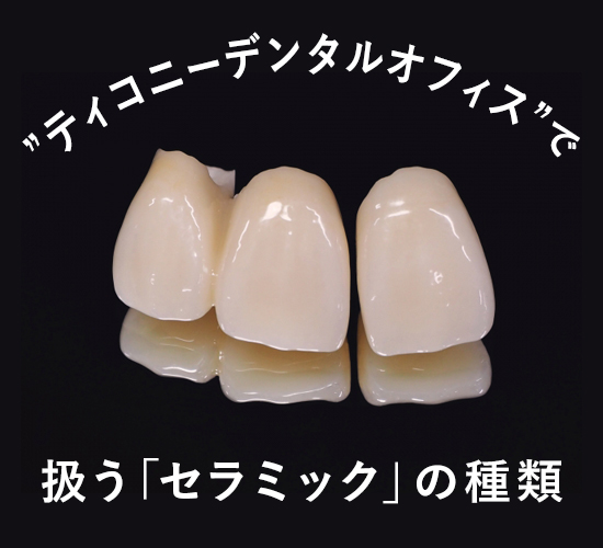 ティコニーデンタルオフィスのセラミックとは？