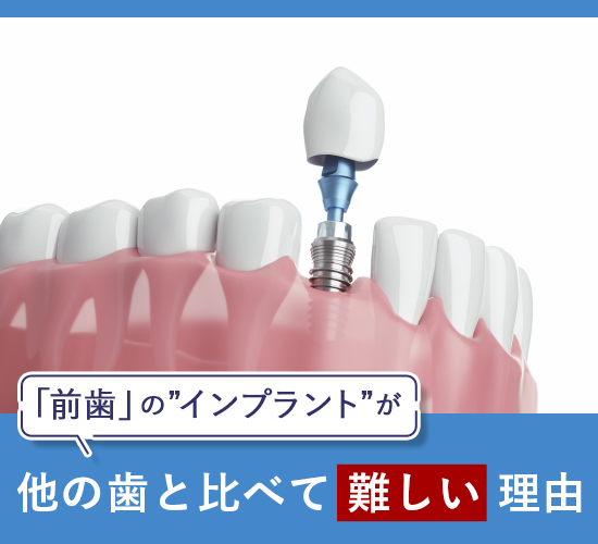 前歯のインプラントがどうして難しいのか