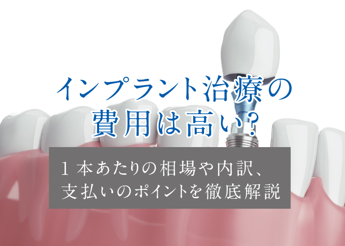 インプラント治療の費用について解説