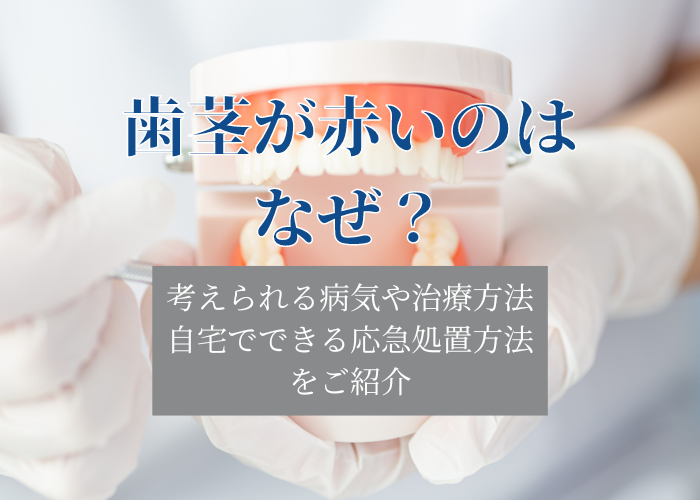 歯茎が赤い原因や対処方法について