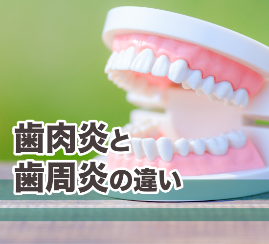 歯周病の進行について