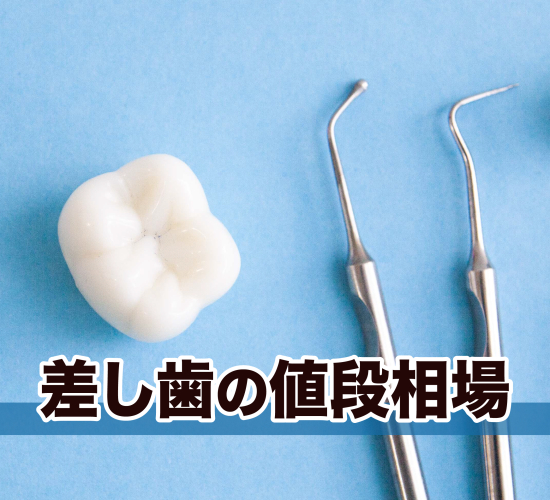 差し歯の治療費について解説