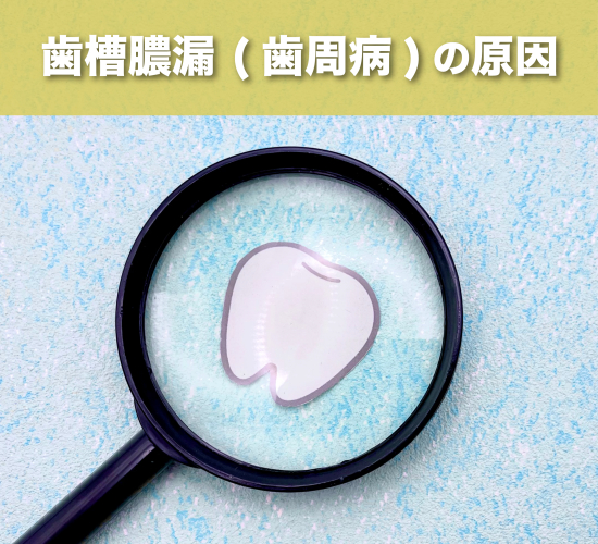 歯槽膿漏の原因とは