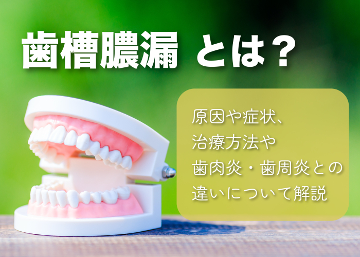 歯槽膿漏や歯周病について解説