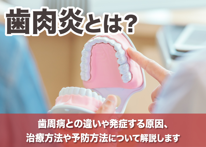 歯肉炎の特徴や治療方法について解説