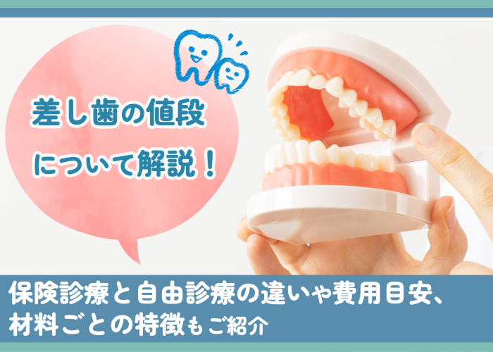差し歯の値段について解説