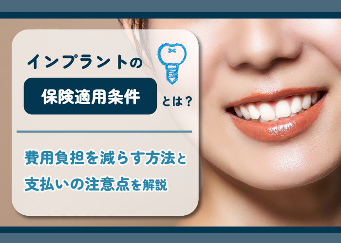 インプラントの費用について解説