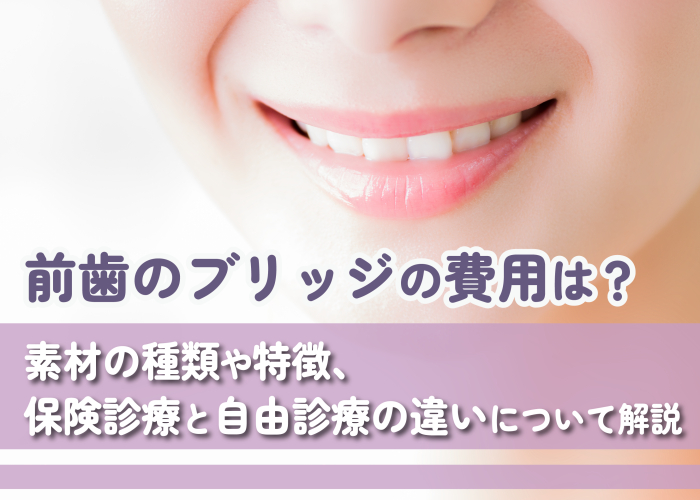 前歯のブリッジの費用について解説