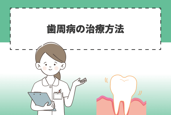 歯周病の治療方法