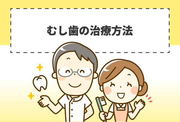 むし歯の治療方法