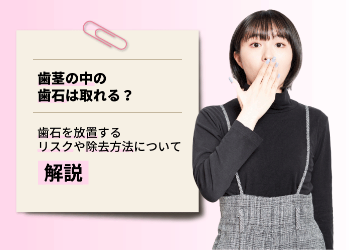 歯茎の中の歯石は取れる？歯石を放置するリスクや除去方法について解説