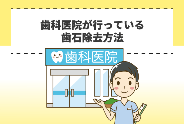 歯科医院が行っている歯石除去方法