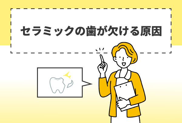セラミックの歯が欠ける原因