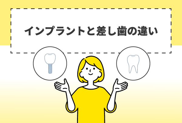 インプラントと差し歯の違い
